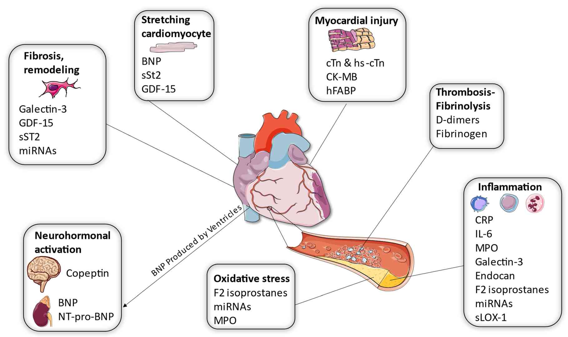 Myocardial Infarction Management Through Drug Level Monitoring ...