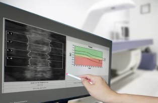 Optimizing Bone Metabolism Therapy Through Drug Monitoring - Creative ...