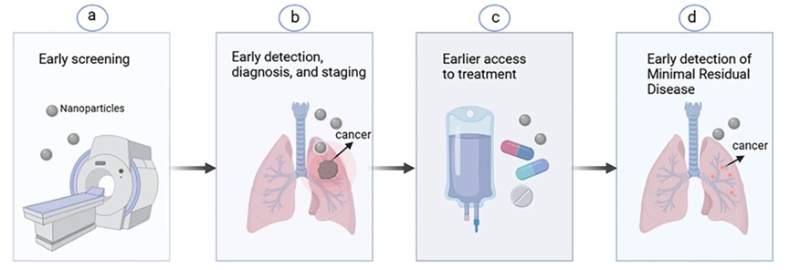Snapshot of Personalized Lung Cancer Management And Planning
